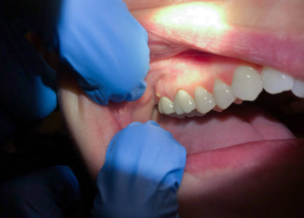 Best Emergency Tooth Extraction  in Maxton, NC